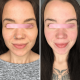 Мікрострумовий ліфтинг MEDICA+ Skin Lifting 6.0 pink (Japan)