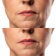 Мікрострумовий RF Lifting Масажер для обличчя Skin Lifting 7.0 White - EMS, LED (Japan)