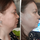Мікрострумовий RF Lifting Масажер для обличчя Skin Lifting 7.0 Pink - EMS, LED (Japan)