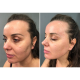 Мікрострумовий ліфтинг MEDICA+ Skin Lifting 6.0 white (Japan)