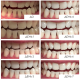 Відбілювальні смужки MEDICA+ 3DWhite Strips