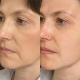 Порозвужувальна маска для обличчя MEDICA+ Pore Control Mask (50 мл)